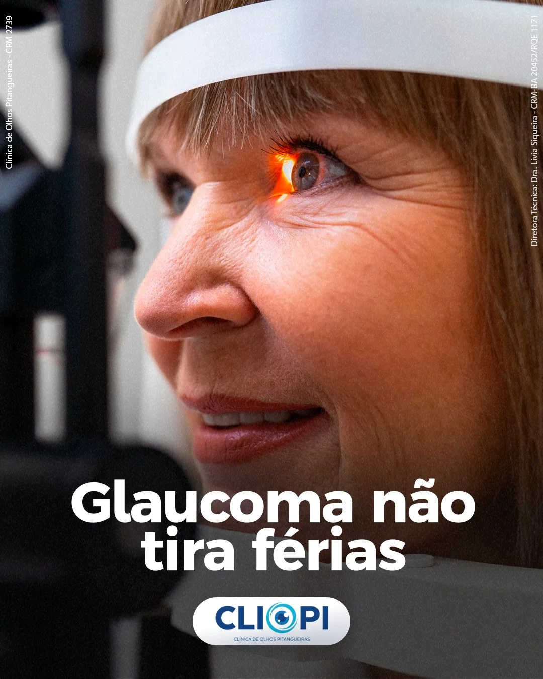 Post Glaucoma — CLIOPI